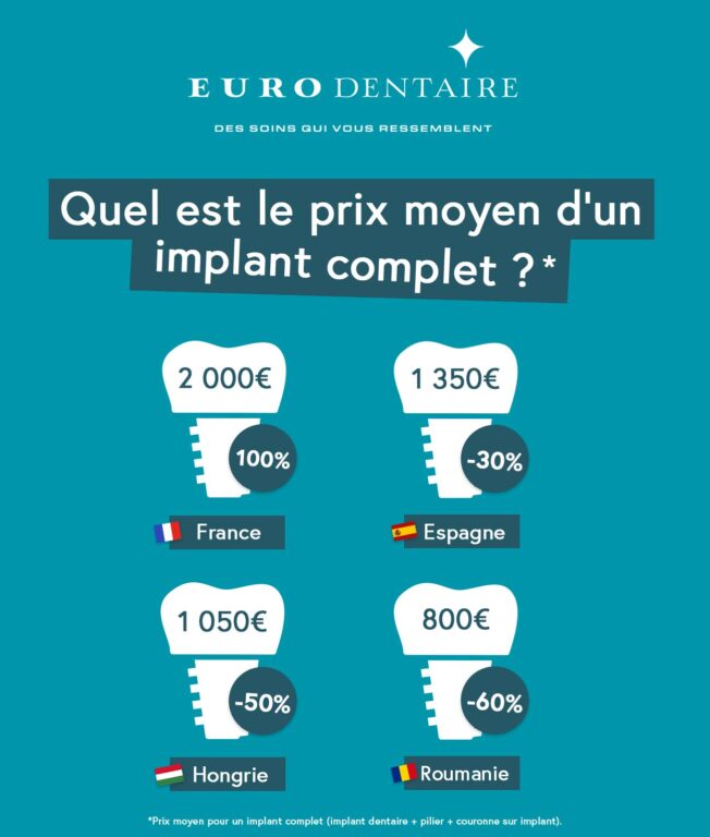 Prix Implant Dentaire Et Tarif Implant Dentaire Eurodentaire