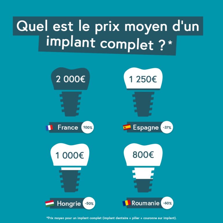 cout implant dentaire france etranger