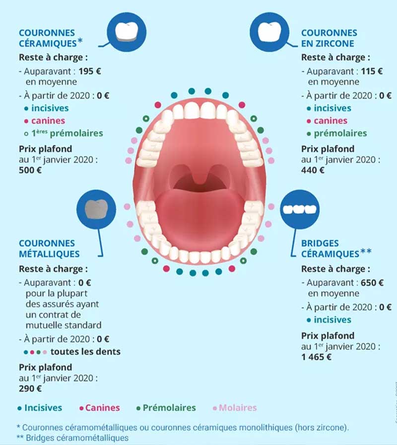 infographie Ameli panier sante soins dentaires